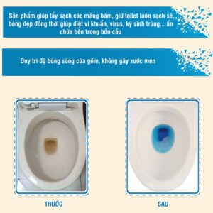 Tui 10 Vien Khu Mui Tay Bon Cau Khu Mui Hoi Sach Mang Bam Vi Khuan Tha Xa Toilet Diet Khuan Tay Sach Ve Sinh Vet Bam Ban 7